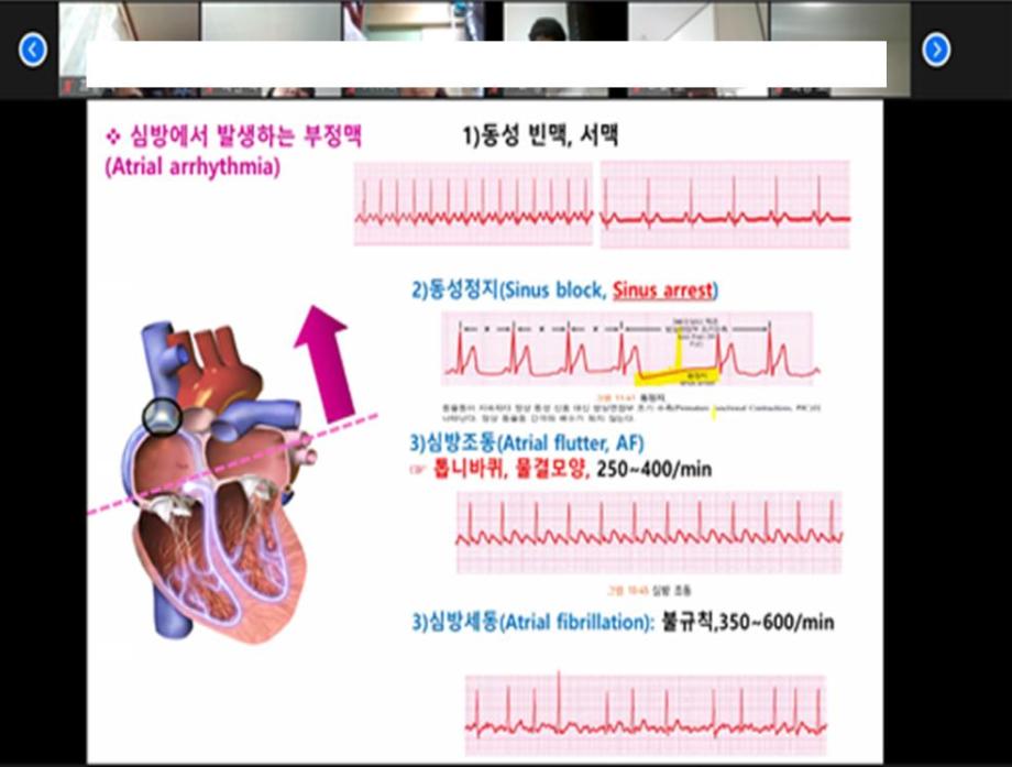 간호사 국가고시 특강(심혈관계 : EKG)